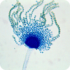 Aspergillus Flavus vegatest warszawa Aflatoksyny Mykotoksyny