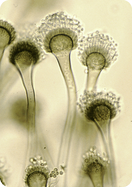 Aspergillus  Fumigatus warszawa vegatest