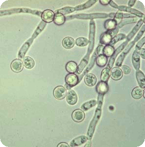 Candida vegatest warszawa kandida