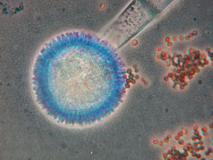 Aspergillus  Fumigatus vegatest warszawa grzybniaki